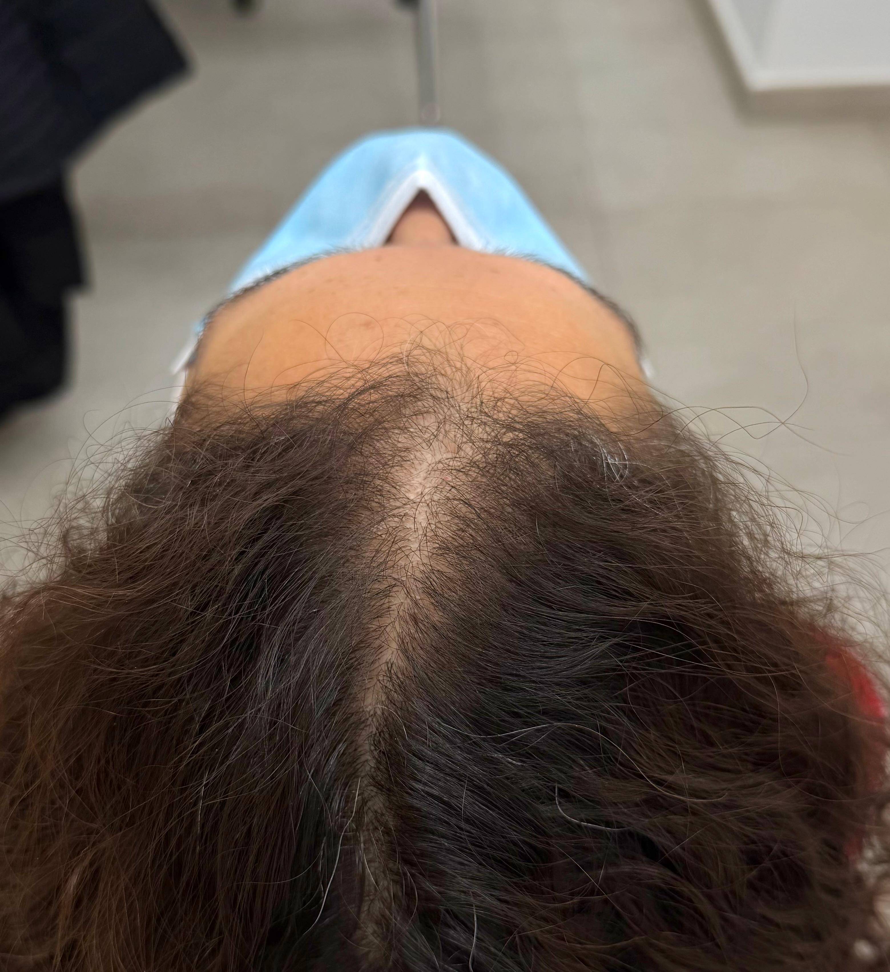 Después del tratamiento · Caso 4